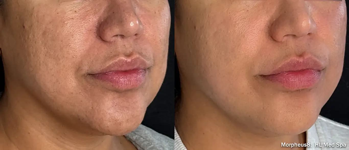 Face · Texture & Pigmentation