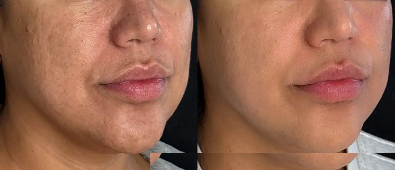 Face & Jawline