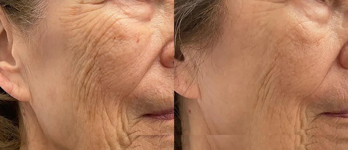 Skin Texture