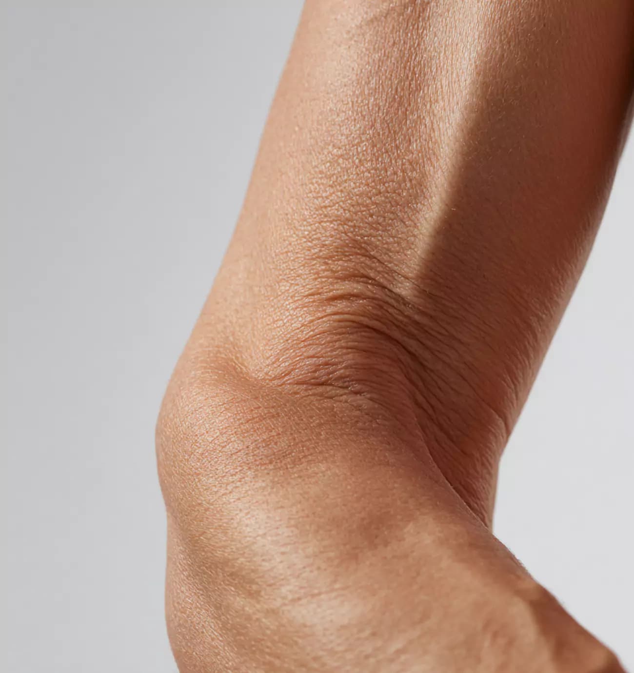 skin-laxity